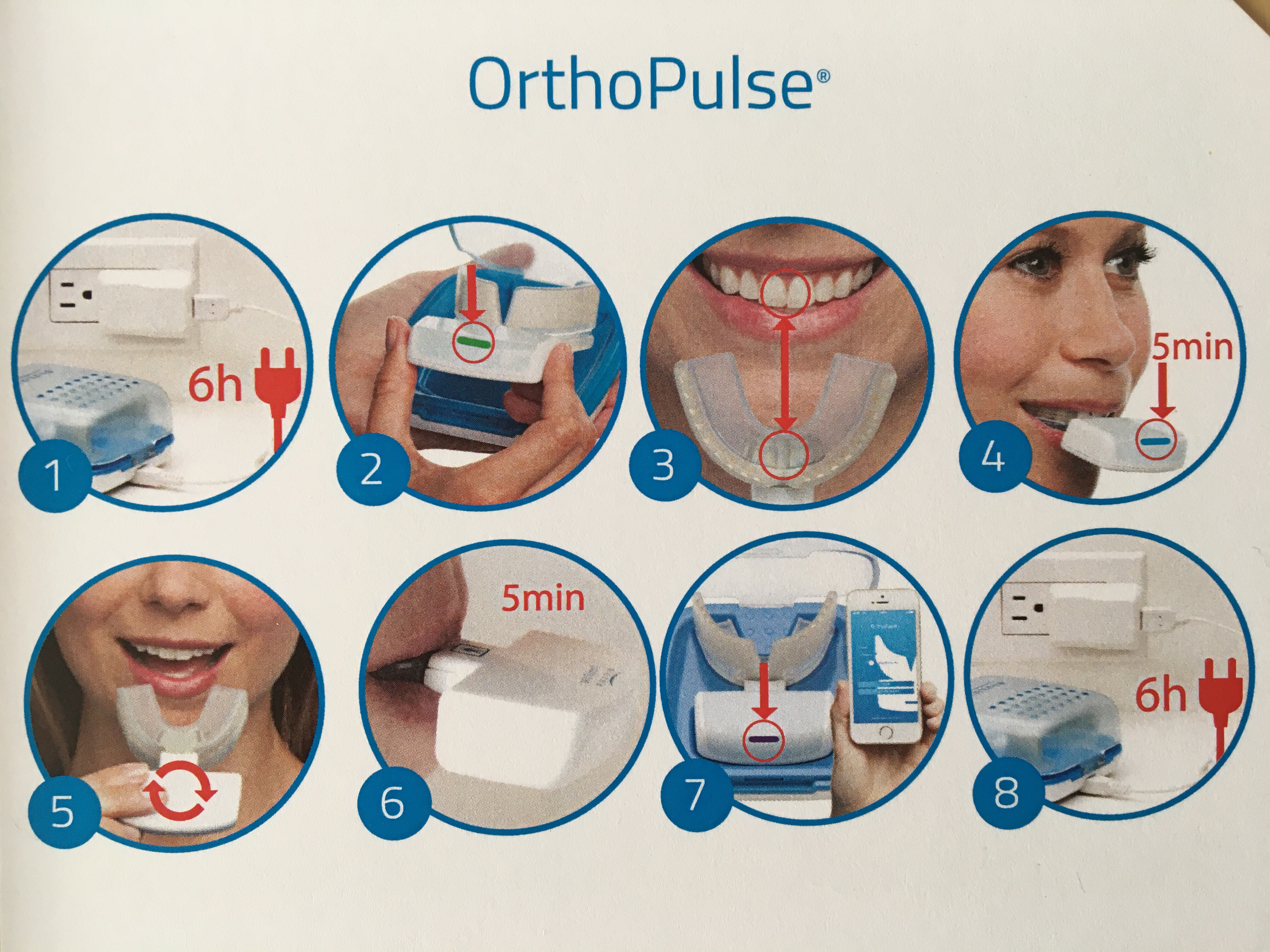 オーソパルス（オルソパルス、OrthoPulse）歯列矯正加速装置 