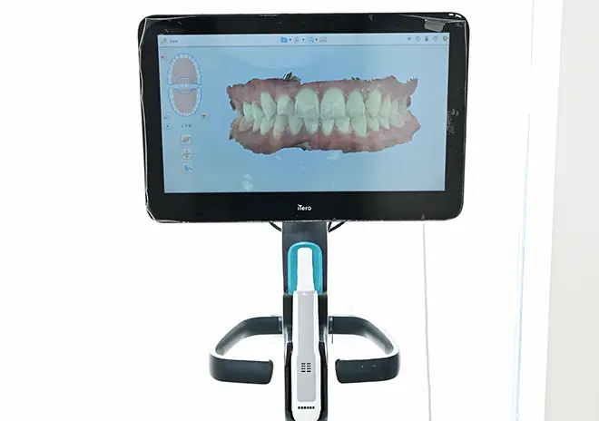 3Dデジタルスキャナー