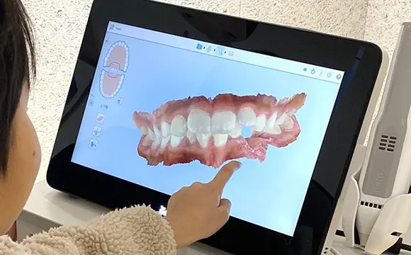 治療後に「こうなる！」がすぐわかる、デジタルシミュレーション