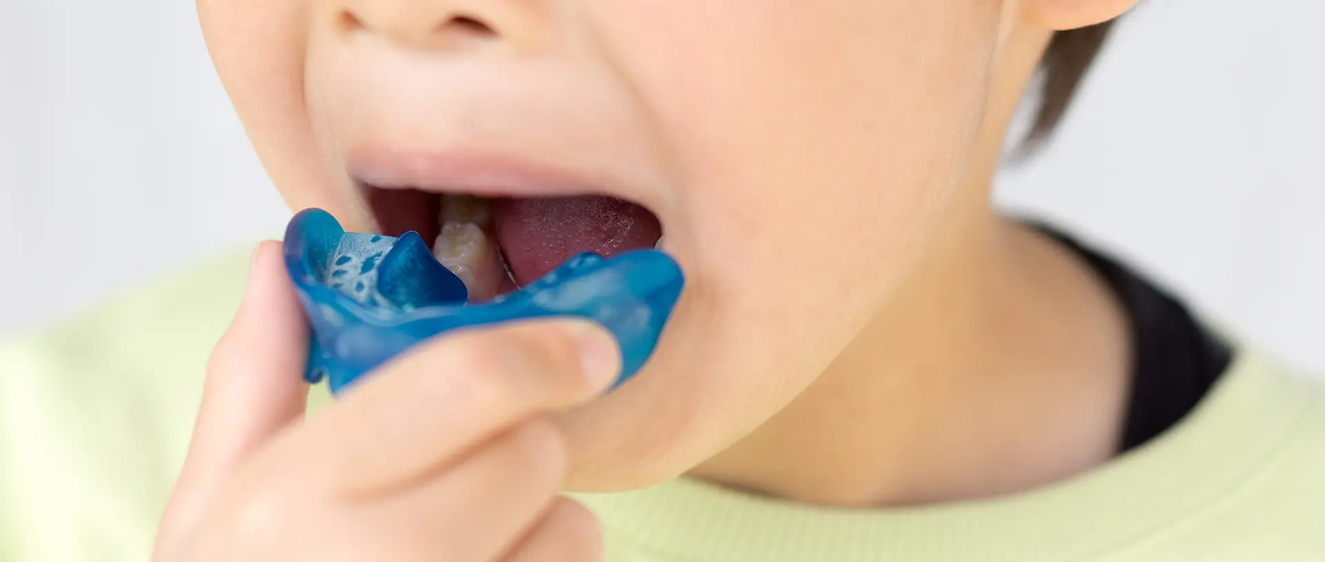 歯列矯正用咬合誘導装置「プレオルソ」