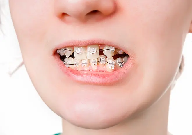 幅広い症例に対応可能