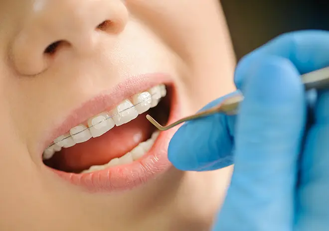 自分で管理する手間が無い