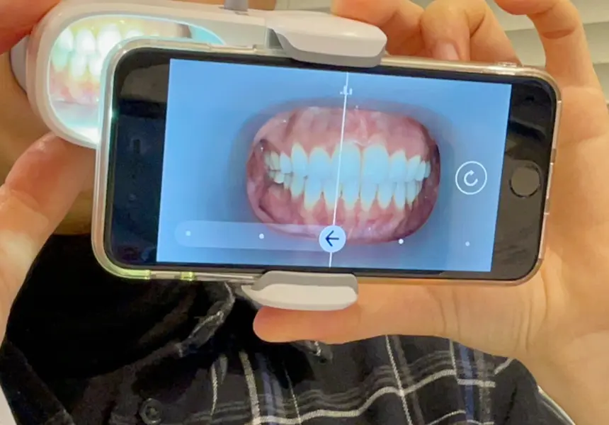 アプリの音声ガイドに従ってお口の中を撮影