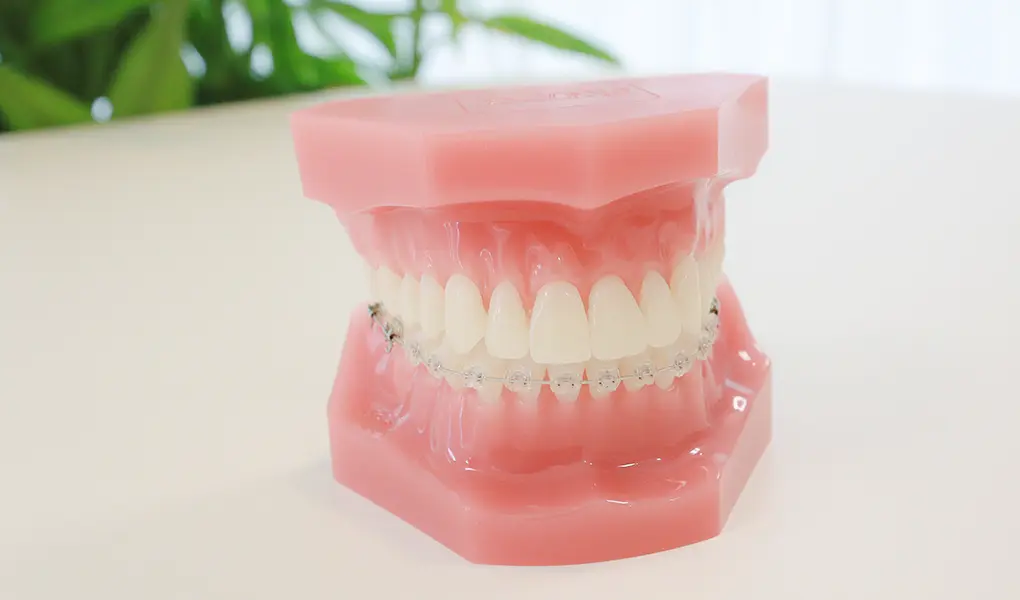 審美型ブラケット