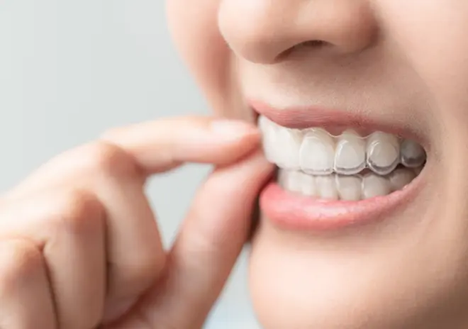 装着時の痛みがほとんどない