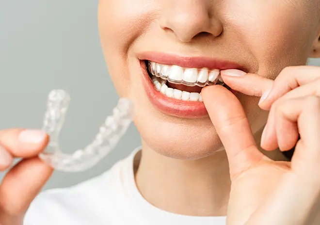 取り外し可能で衛生的に装着できる