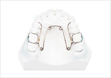 矯正治療について vol.3