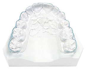 矯正治療日記 vol.10　部分矯正 ④