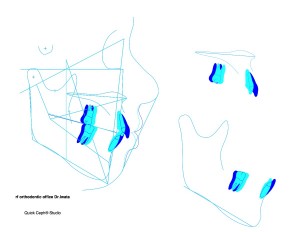 Comparison-ABO Gallery