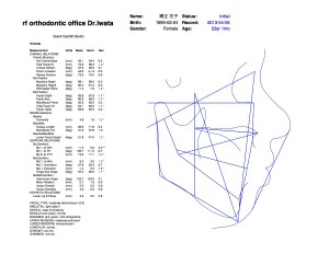 矯正治療では必ず抜歯するのですか？