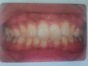 ブログ始める！