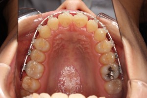 やっぱり悩む。。。