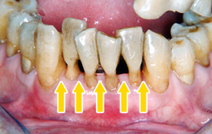 歯並び、噛み合わせが…