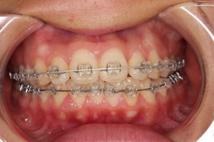 姉を道連れに・・・