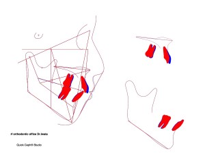 Comparison-ABO Gallery