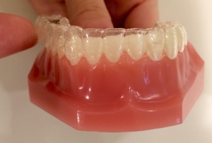 矯正治療日記 vol.16　「インビザラインの取り外し方」