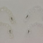 インビザラインの毎日のお手入れ（２週間使用したものと比べてみました）