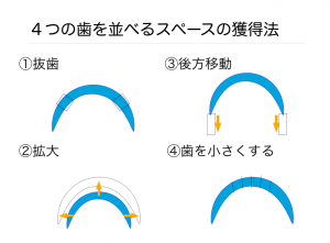 歯を抜かない矯正治療はどこまで可能ですか？