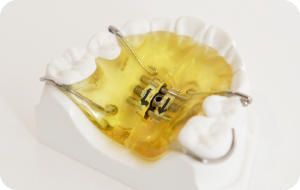 小児矯正で「取り外しのできる装置だけ」できれいな歯並びになりますか？