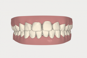 スクリーンショット 2016-07-17 15.32.55
