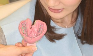 矯正治療日記 vol.24 「インビザラインの型取りとガム」