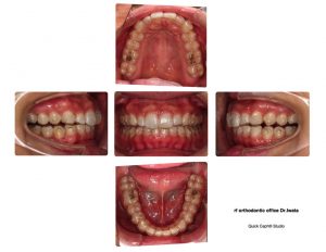 勝負どころ・・