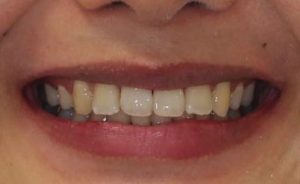 終わって1年半後…