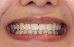 終わって1年半後…