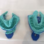 やった！インビザラインの使用時間が…！