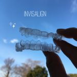 インビザライン２巡目です！