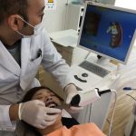 光学印象ー３Dスキャナー