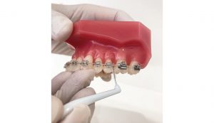 歯と歯の間のお掃除