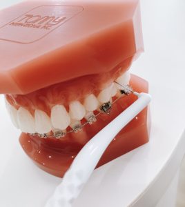 第１０弾！YouTube公開「歯と歯の間のお掃除」