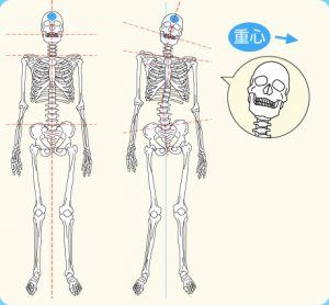 矯正体験談①インビザラインはじめました。