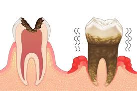 食欲の秋とお口の中について