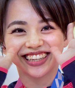 スポーツと歯列矯正