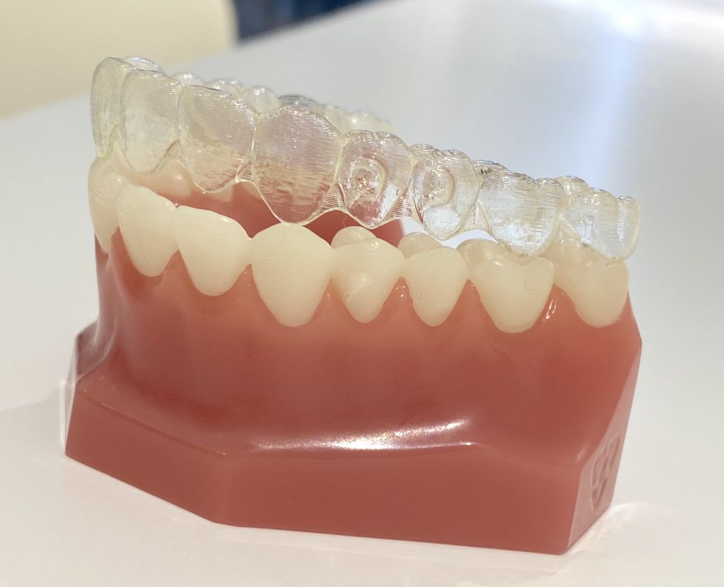 第29弾！YouTube公開「インビザラインがスタートするまで」