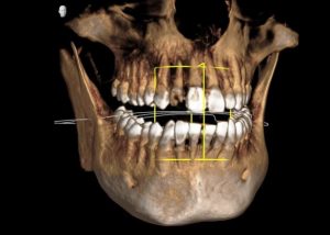 CTを導入しました！
