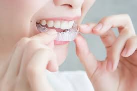 第３５弾！YouTube「マウスピースの取り外しの強い味方」公開