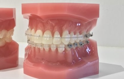 第33弾！YouTube「セパレート＆バンド」公開