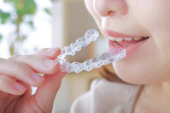 初めてマウスピースを装着してから直後〜数日後に感じやすい症状